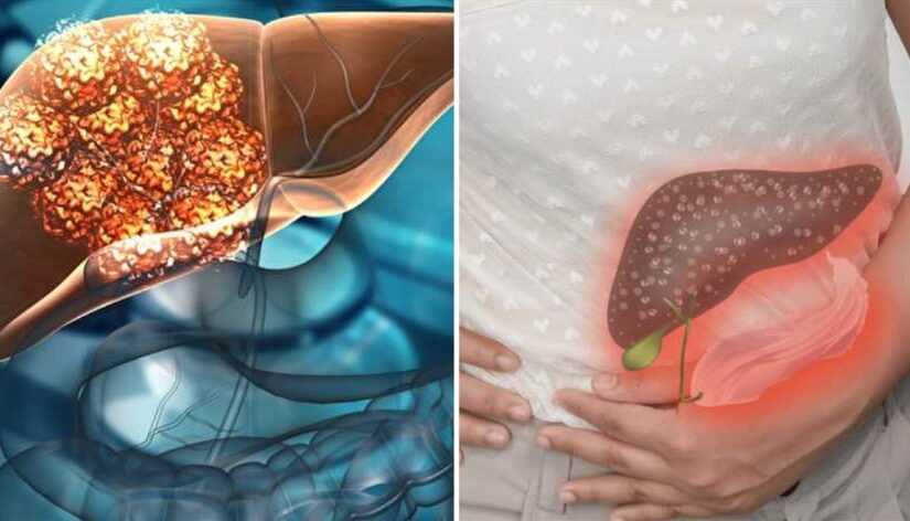 肝硬化不可逆！早上起床「肝不好的人」可能出現4種症狀，若都沒有「恭喜肝還很健康」