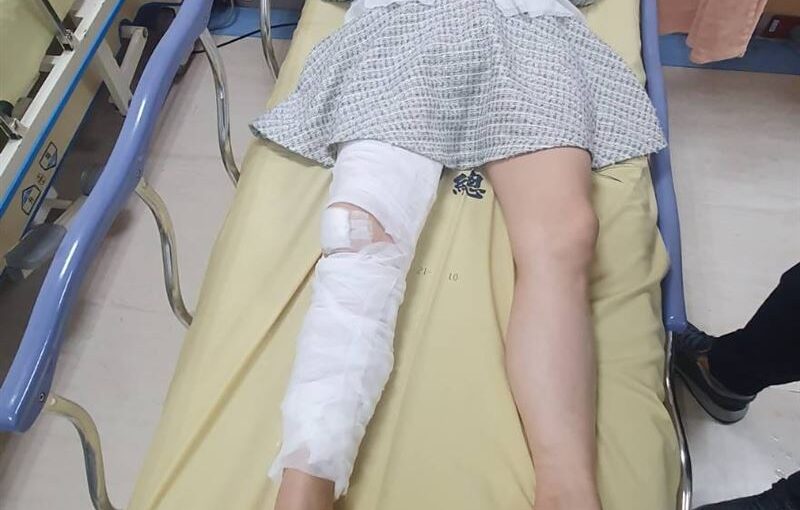 驚傳重傷送醫！60歲許聖梅「傷勢好不了」驚悚畫面曝光　悲吐「有7疾病纏身」又被醫生警告：恐失明