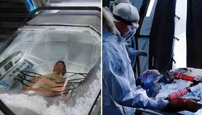 世界首例冷凍人：提前支付50年費用，原定2017年被喚醒，現狀如何