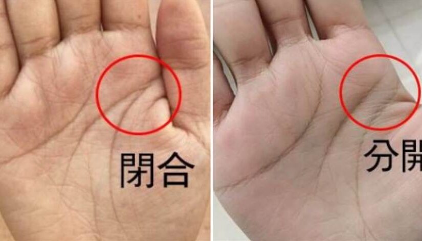 手掌這兩條線「分開」還是「閉合」，預示晚年「福命還是苦命」：太準了！