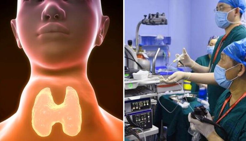 「無聲殺手」食道癌一查就是惡性！其實喉嚨早早給暗示「2癥狀趕快就醫」