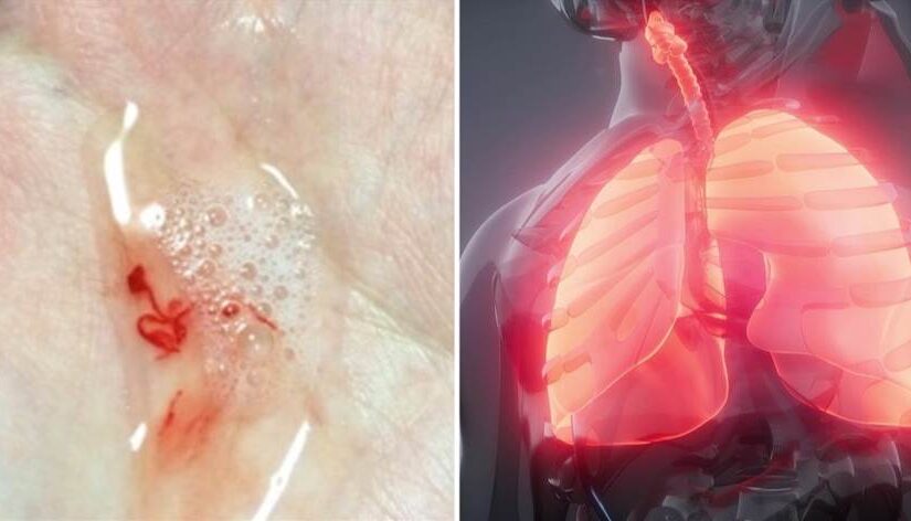 肺癌發出第一個信號！大多「顯示在喉嚨上」　醫生示警「很多人沒在意」：一拖就是晚期…