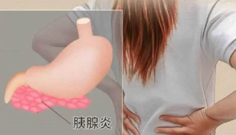 女子每天「大便兩三次」確診胰腺癌！醫生提醒：出現四種異常恐是身體「警報」