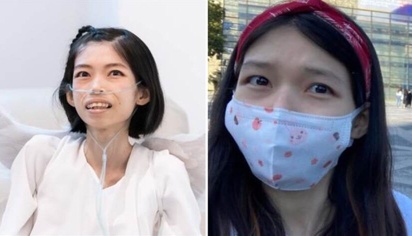 25歲湯佩姿「卵巢癌」病逝！專家曝癥狀警告：「5類人容易得」發現已三四期