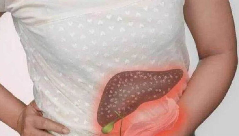 胰腺癌：從確診到死亡僅僅3個月，提醒：「4個徵兆」可能是胰腺在求救