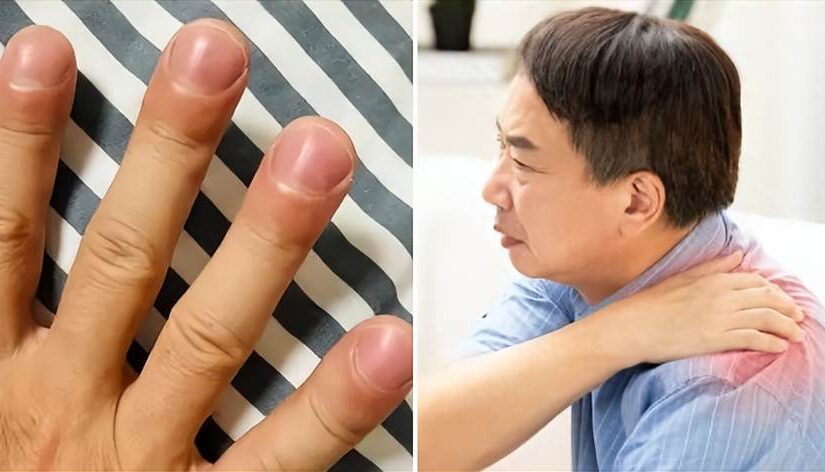 醫生直言 肺癌早期不是咳嗽，是身上出現三大異常，千萬別忽視