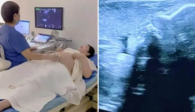 有2女兒「為生男孩」拼三胎，7個月產檢醫生吐密碼「147258」她看半天不懂崩潰，網看後立馬懂了…