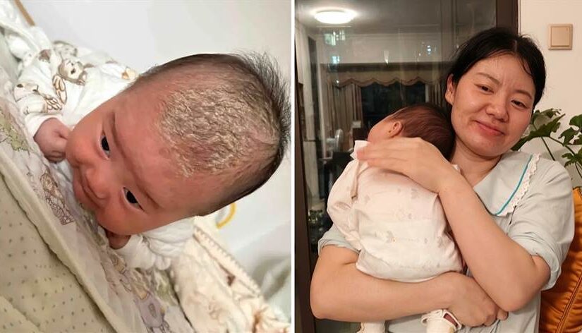 新手媽崩潰！為清寶寶頭上「舅舅屎」摳到流血…網急罵後授1招：半小時乾淨溜溜