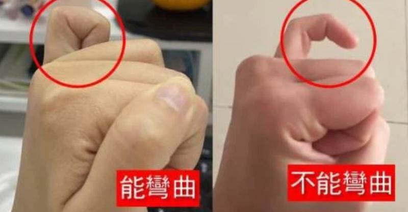 小拇指能不能彎曲，預示晚年「福命還是苦命」：真的太準了