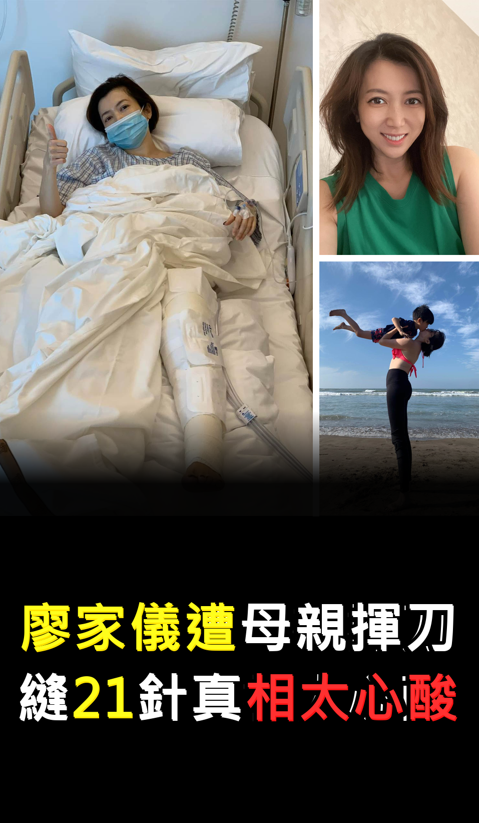 廖家儀遭母親揮刀?縫21針真相太心酸????????