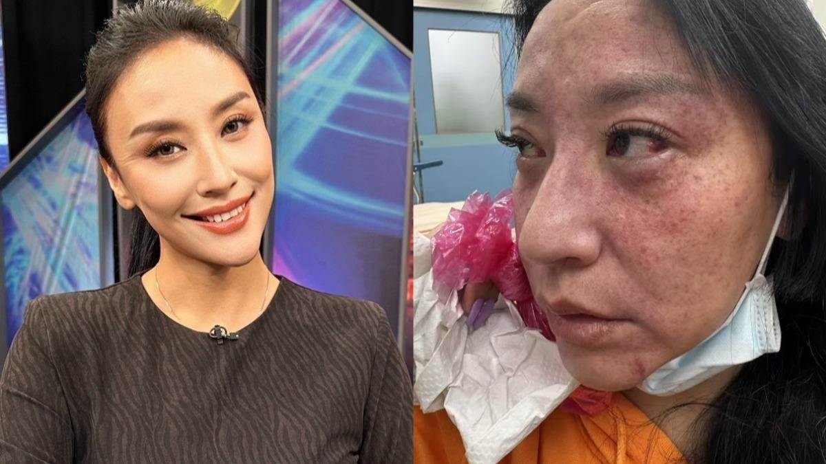 安歆澐婚姻風波爆出激烈衝突,44歲身體狀況一度亮紅燈,對質後才知對方竟是已婚友人