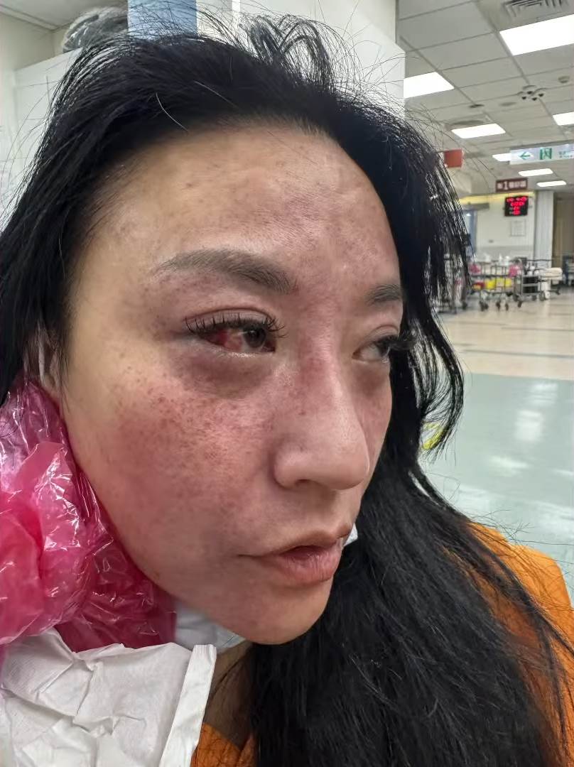 安歆澐婚姻風波爆出激烈衝突,44歲身體狀況一度亮紅燈,對質後才知對方竟是已婚友人