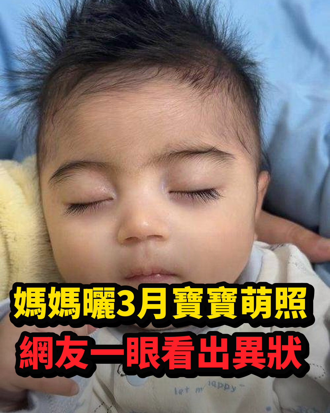 媽媽半夜分享3個月寶寶萌照,網友發現眉眼特徵急勸就醫,檢查結果讓她措手不及