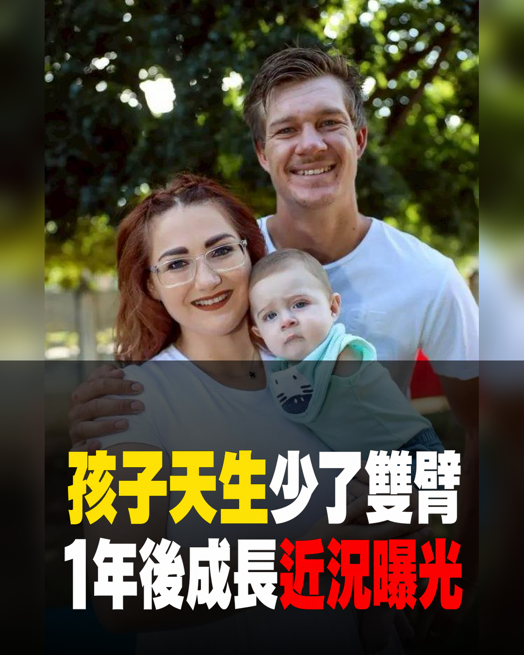 產檢得知孩子天生少了雙臂，父母仍選擇迎接新生命，1年後成長近況曝光