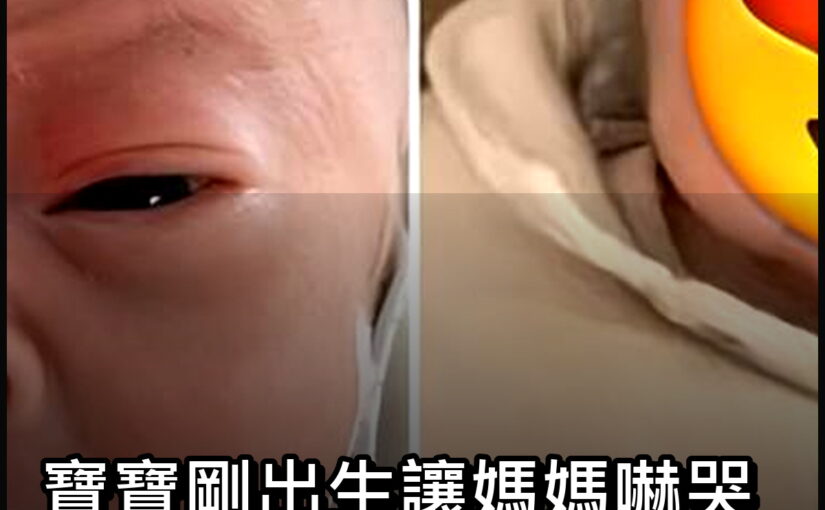 寶寶剛出生讓媽媽嚇哭，3個月後大翻轉，阿嬤笑說差點看走眼