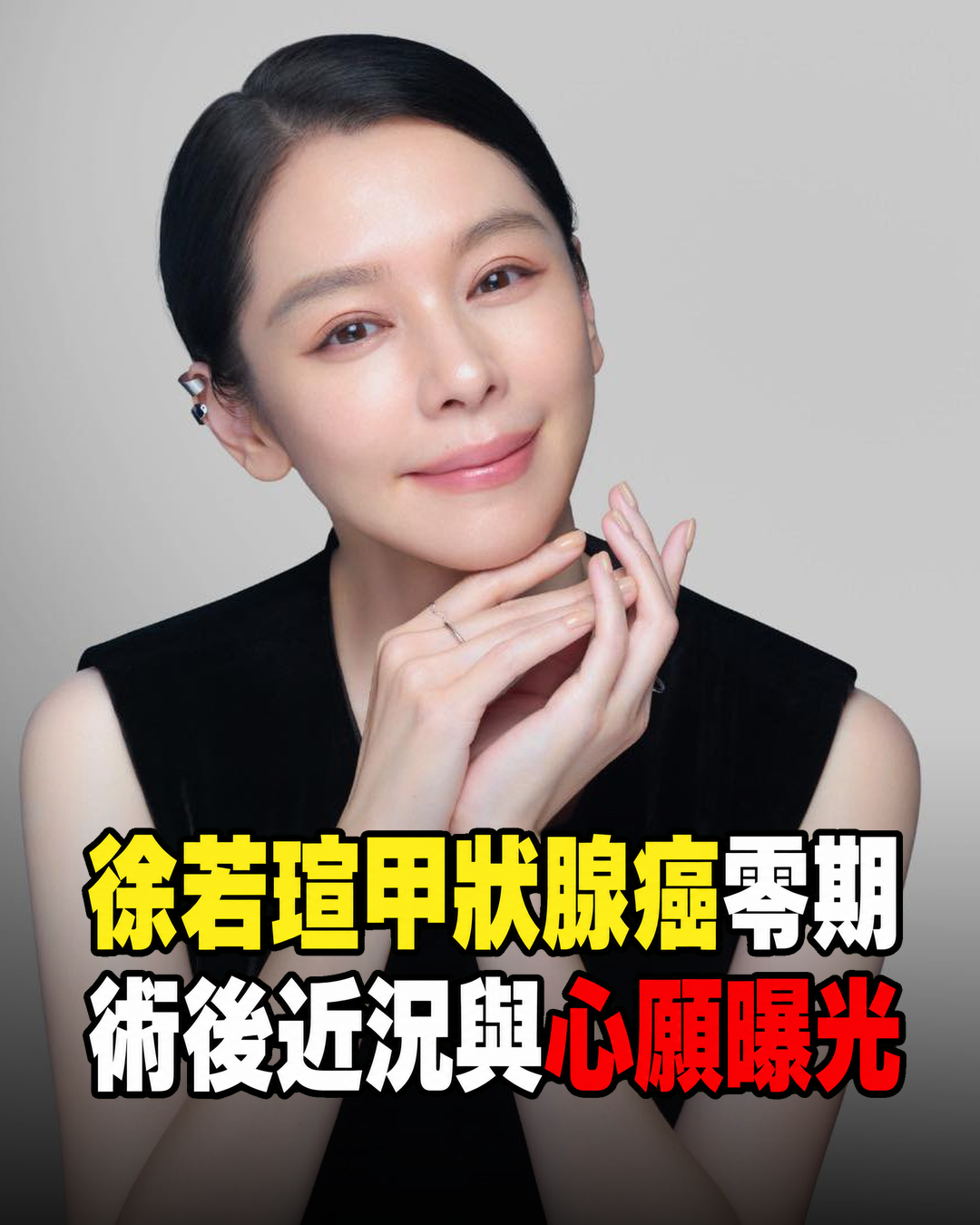 徐若瑄健檢發現甲狀腺癌零期，術後休養近況曝光！50歲生日一句「給我更多時間」令人動容
