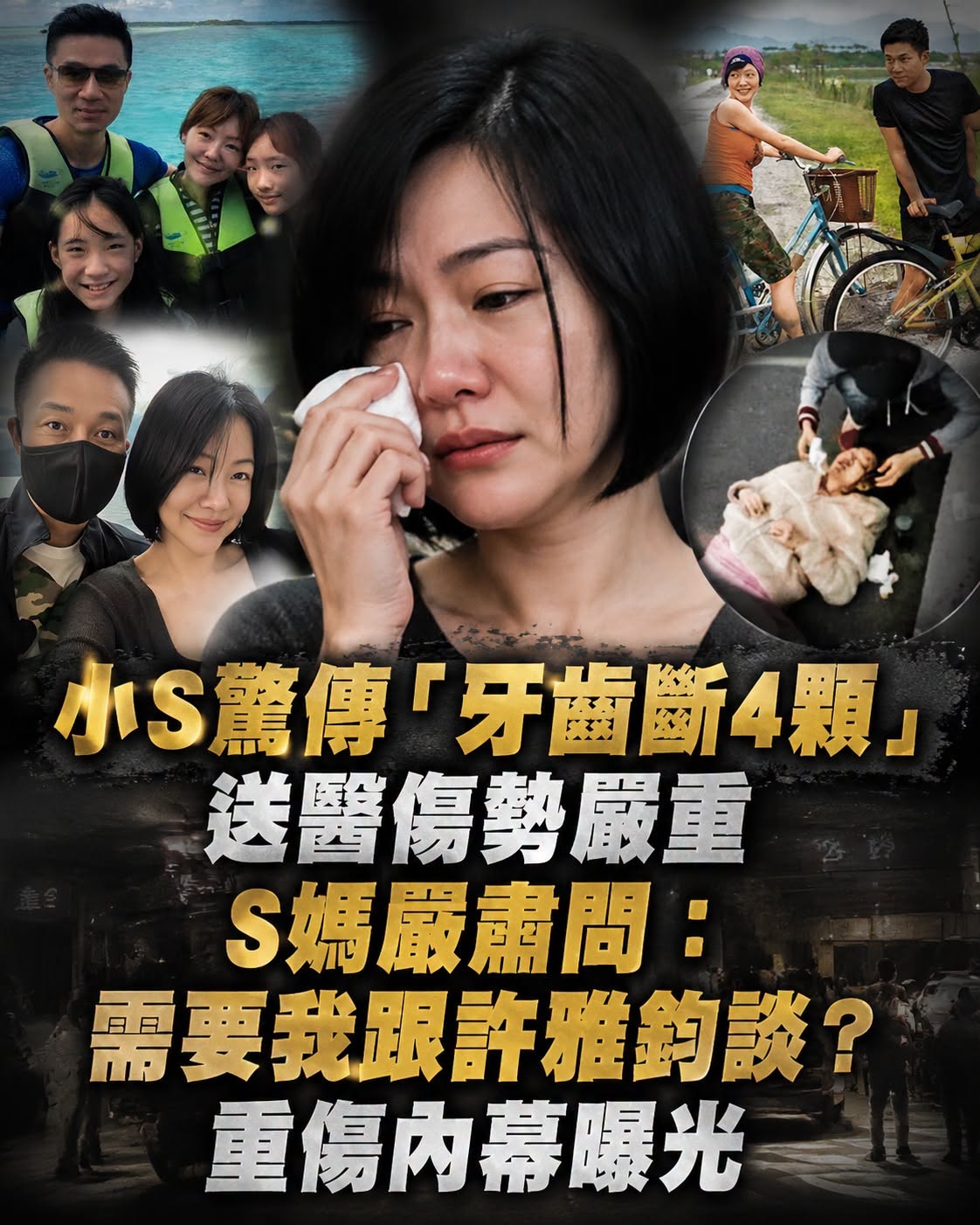 小S曾摔車撞斷4顆牙,S媽急問「要不要我跟許雅鈞談?」真相是這場意外