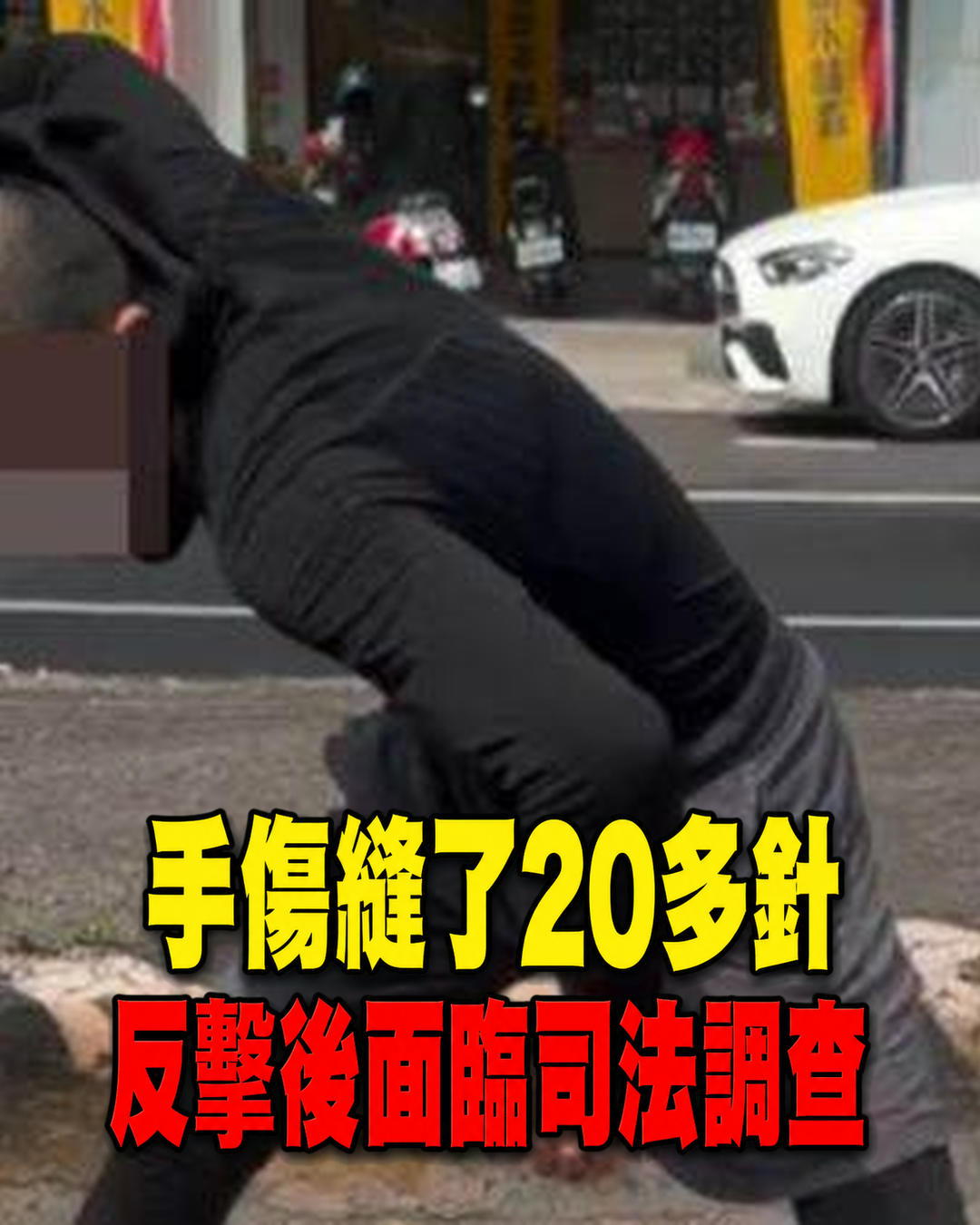 台中超車糾紛釀憾事,葉姓男子手傷縫20多針,反擊後面臨的關鍵爭點曝光