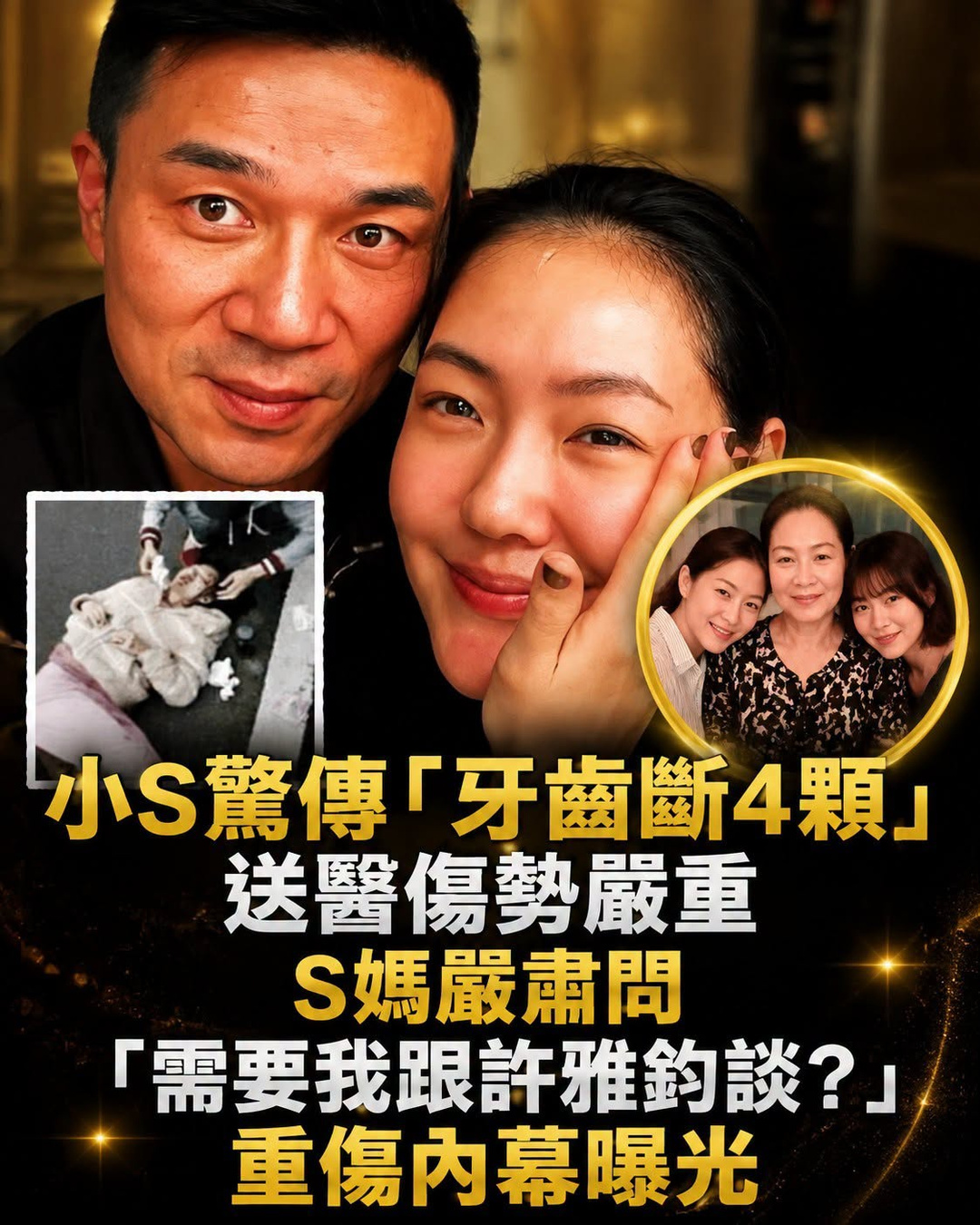 小S驚傳「牙齒斷4顆」送醫傷勢嚴重,S媽嚴肅問:「需要我跟許雅鈞談?」重傷內幕曝光