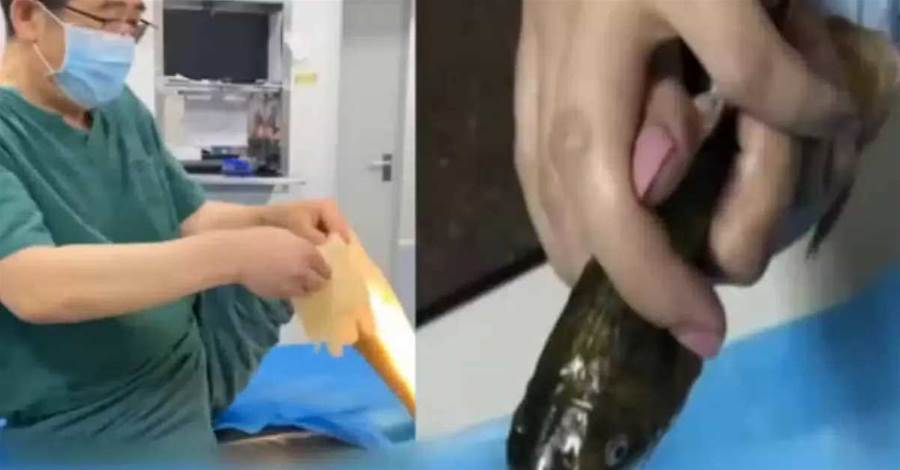 女子抱著活黃魚衝醫院,痛喊「救救我」,醫護一看才發現事情不單純