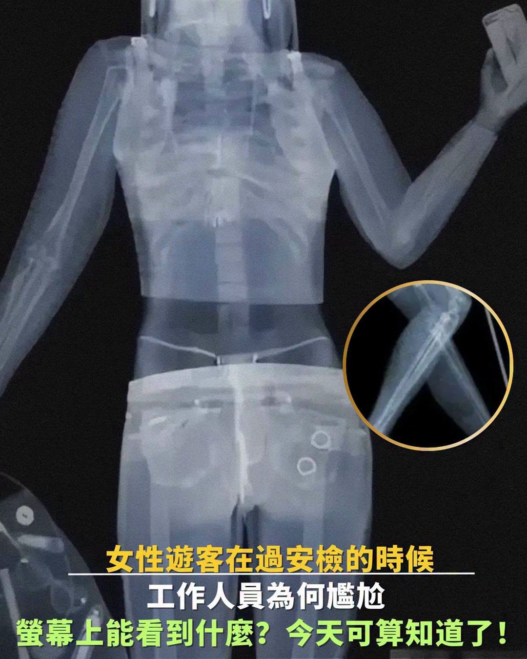 女性過安檢總讓工作人員表情尷尬,真正原因竟和身體影像有關