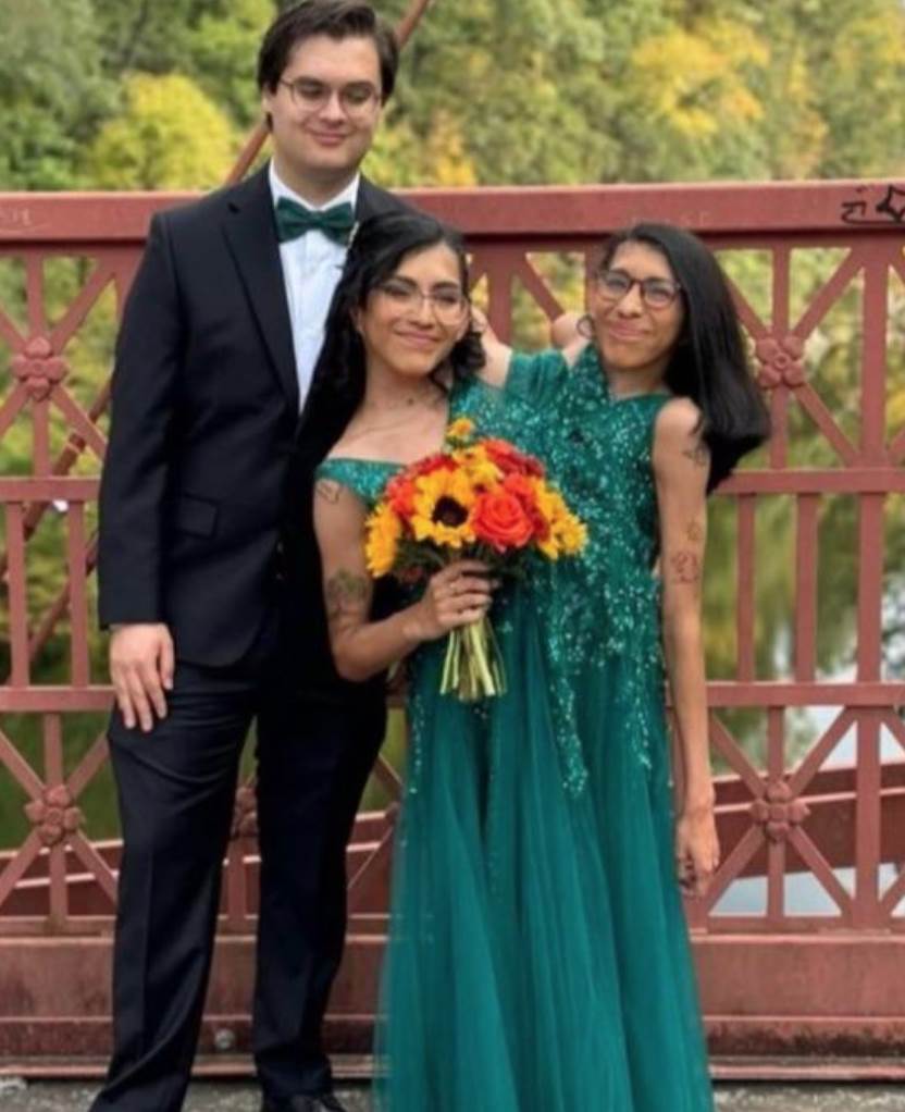 醫師曾估活不過3天，連體姊妹姊姊結婚後3人怎麼面對私密問題？