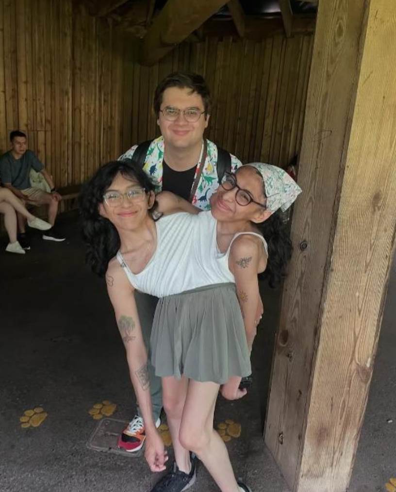 醫師曾估活不過3天，連體姊妹姊姊結婚後3人怎麼面對私密問題？