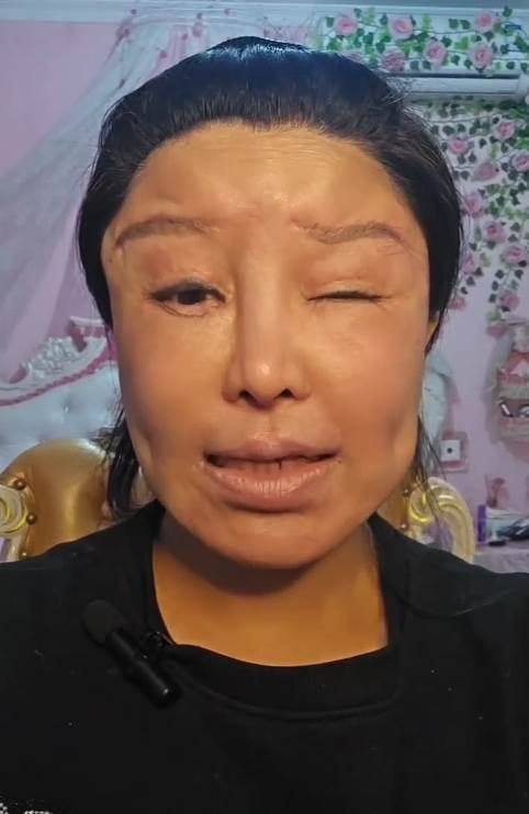 紅粉寶寶42歲砸逾4000萬整形200多次，外貌反被說像60歲她最後想要的不是美貌