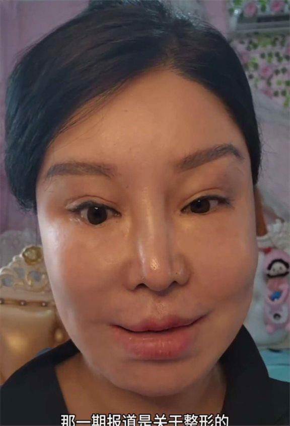 紅粉寶寶42歲砸逾4000萬整形200多次，外貌反被說像60歲她最後想要的不是美貌