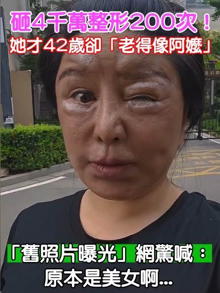 紅粉寶寶42歲砸逾4000萬整形200多次，外貌反被說像60歲她最後想要的不是美貌