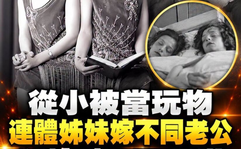 活到60歲的連體姊妹「嫁不同老公」，從被當玩物到爭取自由，結局藏著一段遺憾