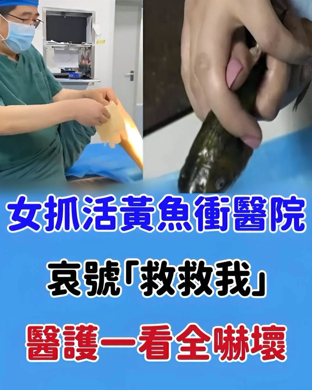 女子抱著活黃魚衝醫院,痛喊「救救我」,醫護一看才發現事情不單純