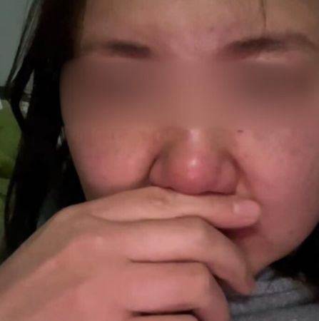 34歲女子拔智齒後連續5天無法進食,最後一則貼文竟成永別