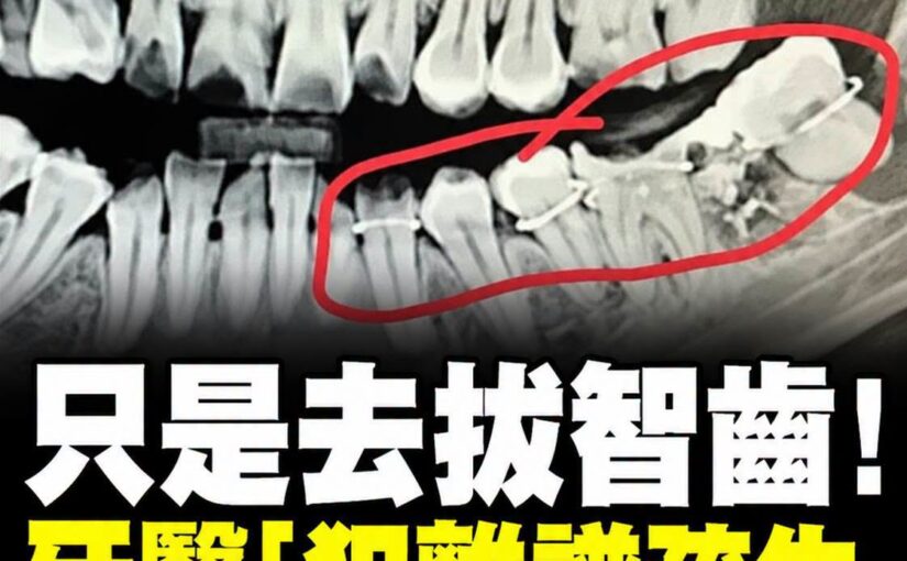 34歲女子拔智齒後連續5天無法進食，最後一則貼文竟成永別