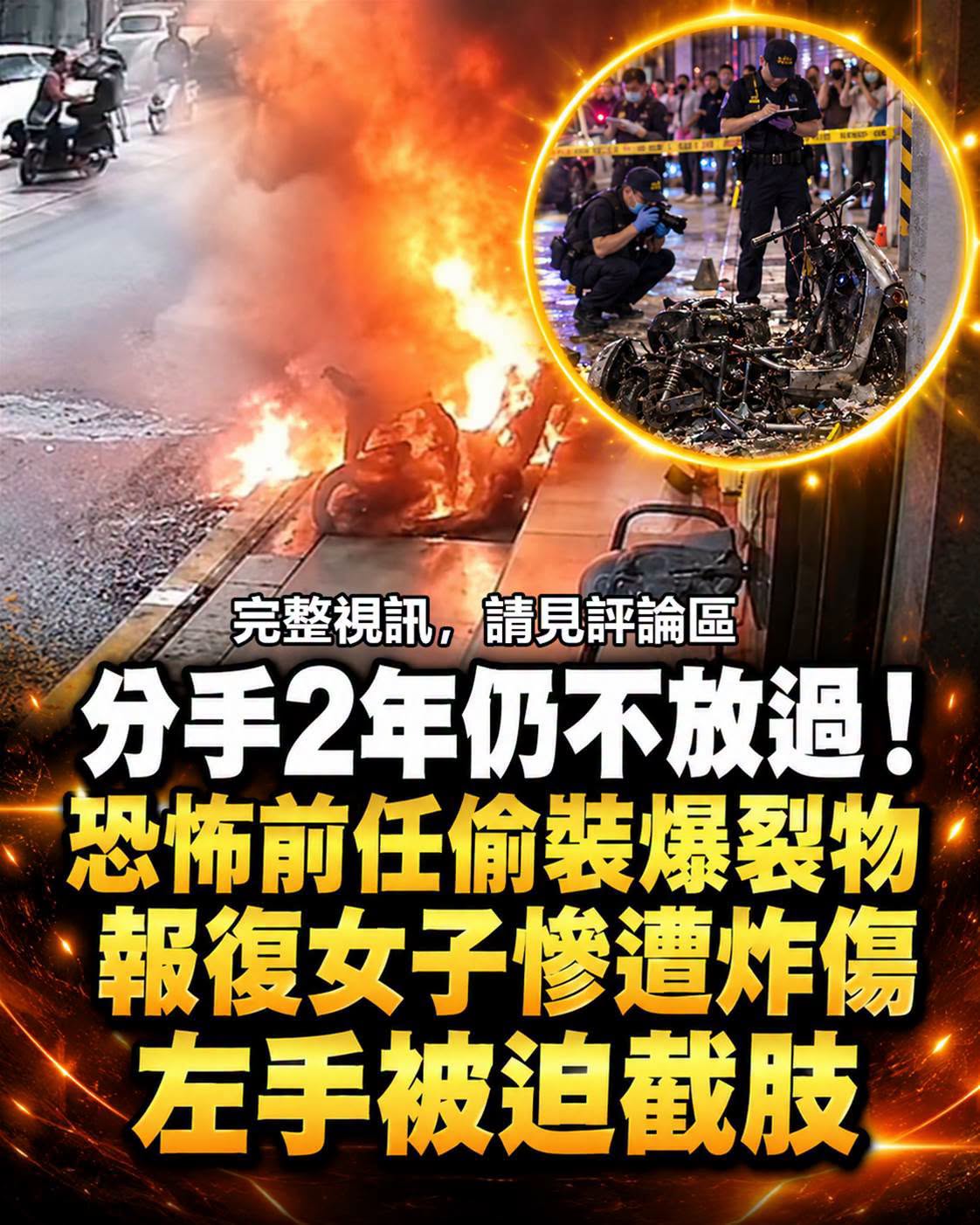 分手2年仍不放過！恐怖前任「偷裝爆裂物報復」女子慘遭炸傷，左手被迫截肢