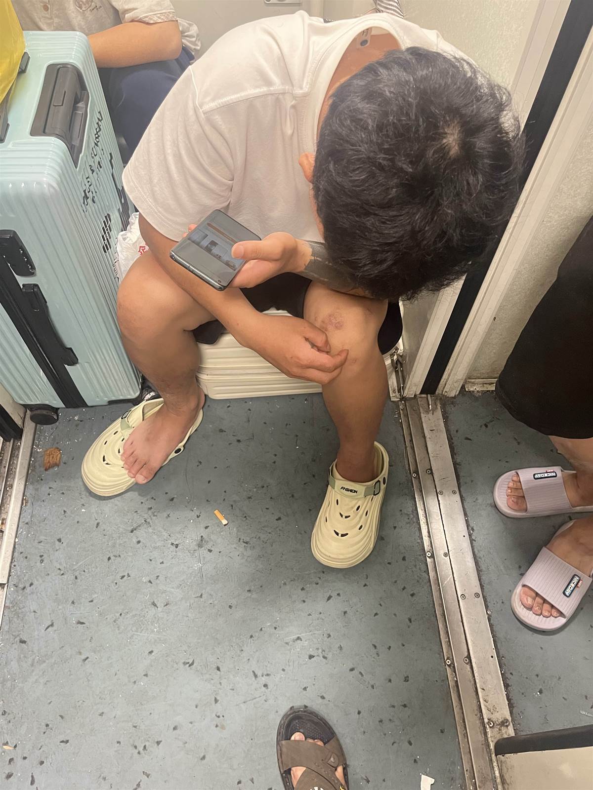 紋身男膝蓋冒出異常肉芽，車廂內頻頻抓癢，後續真相讓人不敢只靠肉眼判斷
