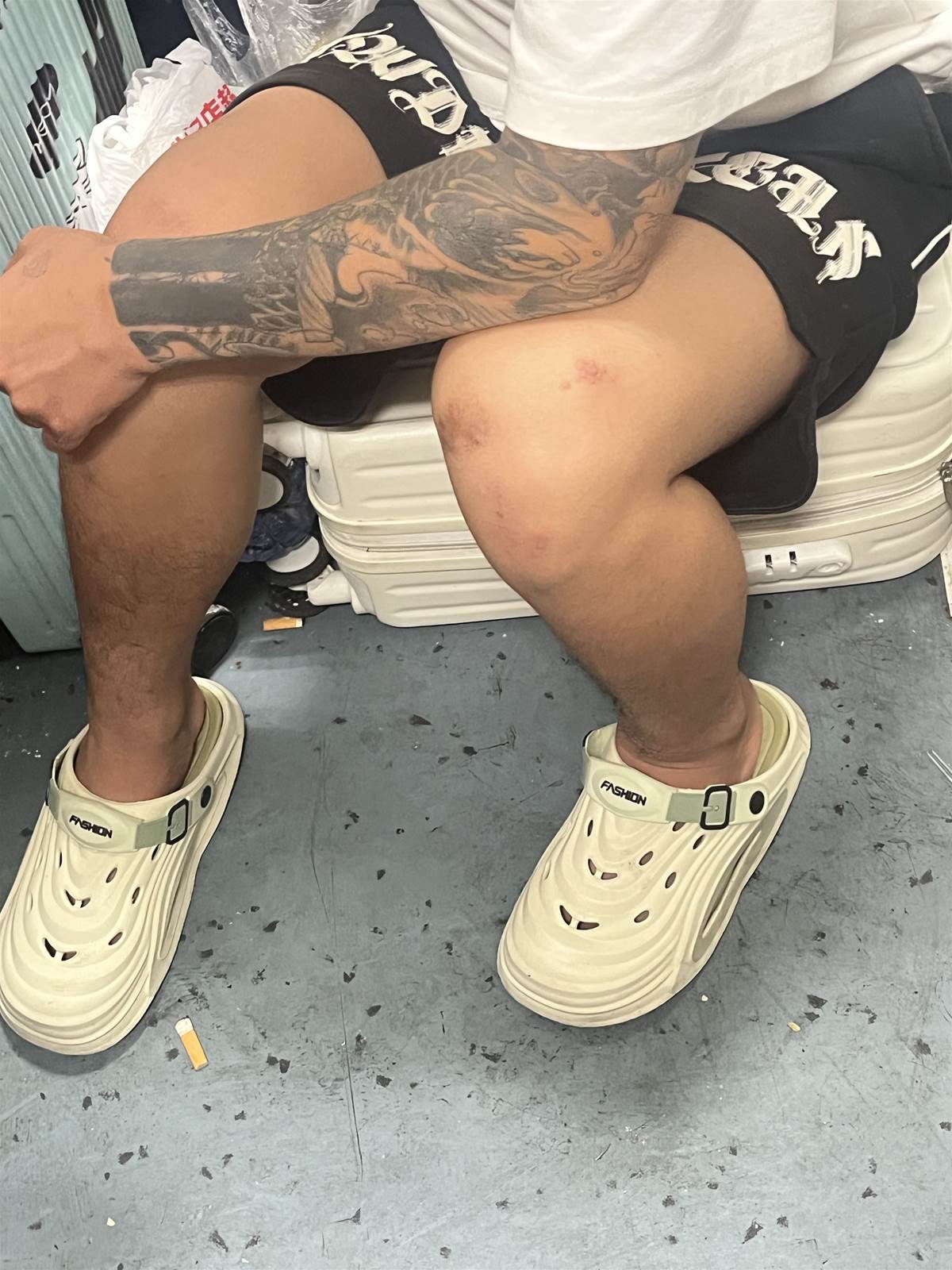 紋身男膝蓋冒出異常肉芽，車廂內頻頻抓癢，後續真相讓人不敢只靠肉眼判斷