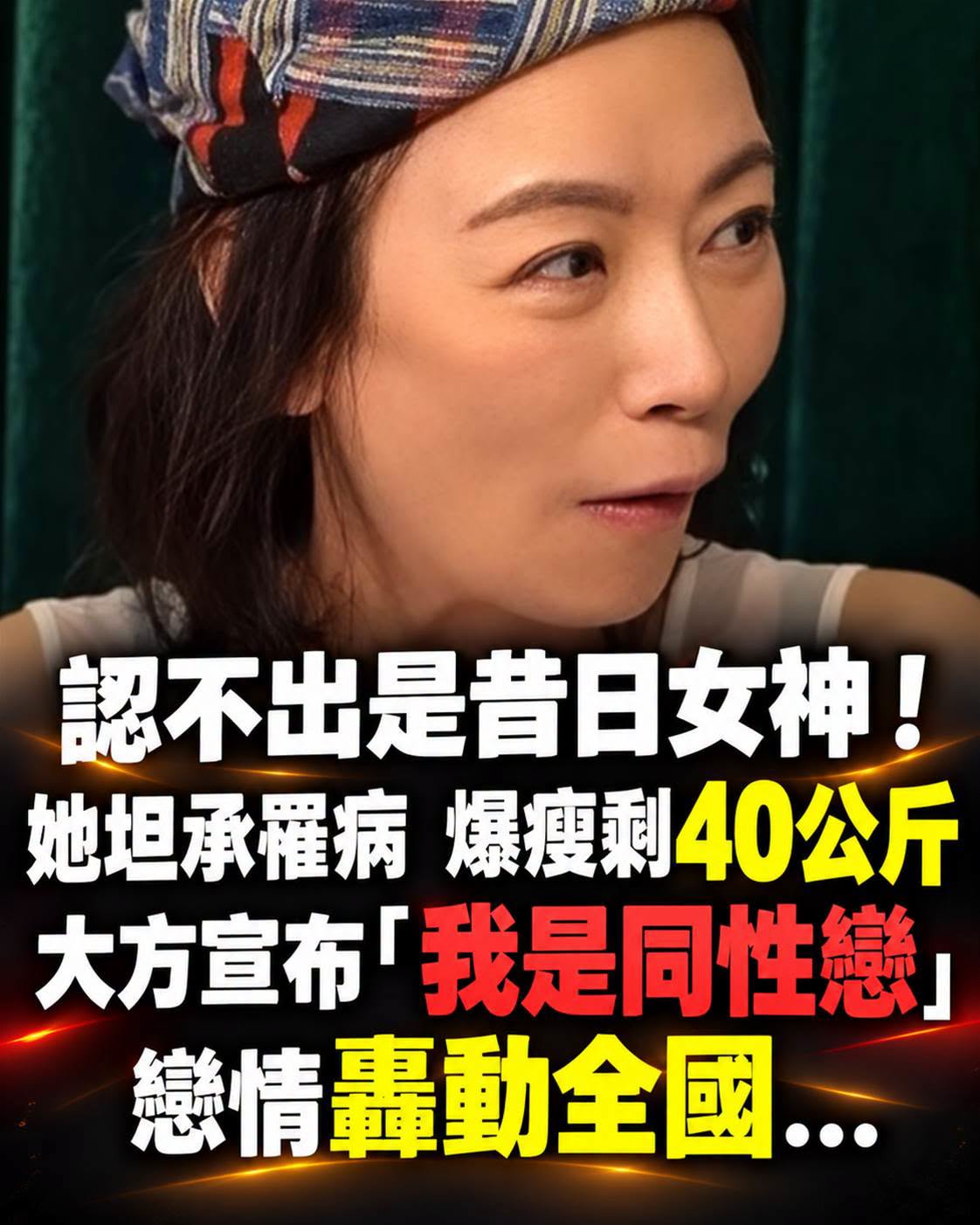 55歲昔日短髮女神瘦到不到40公斤，坦承病情反覆…近況讓粉絲心疼