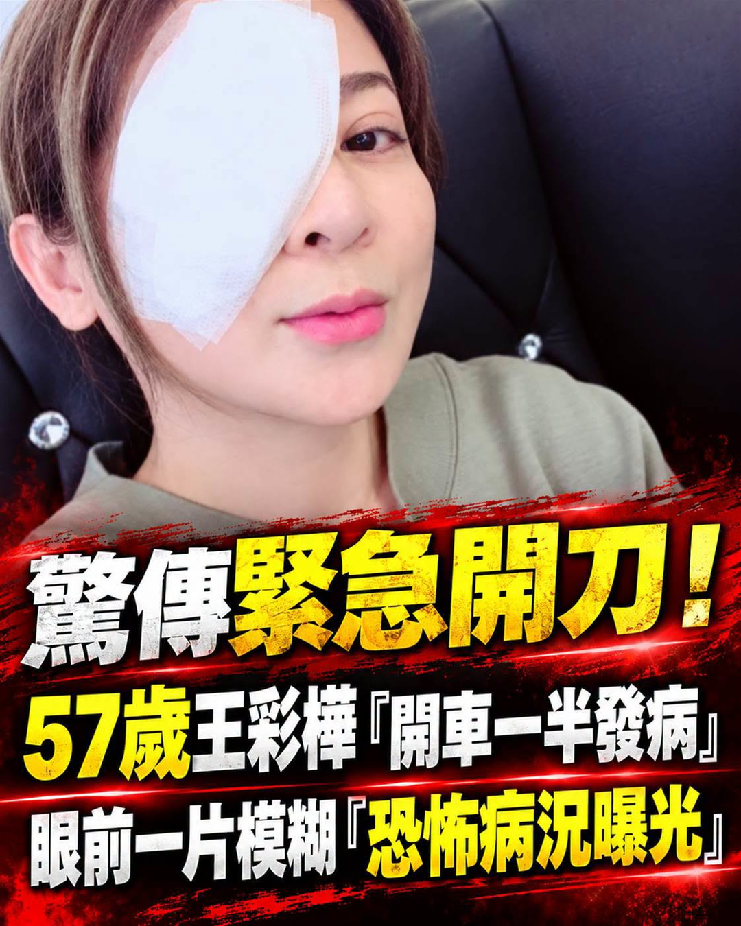 57歲王彩樺曾在路上視線起霧,兩次手術後終於找回清晰視力