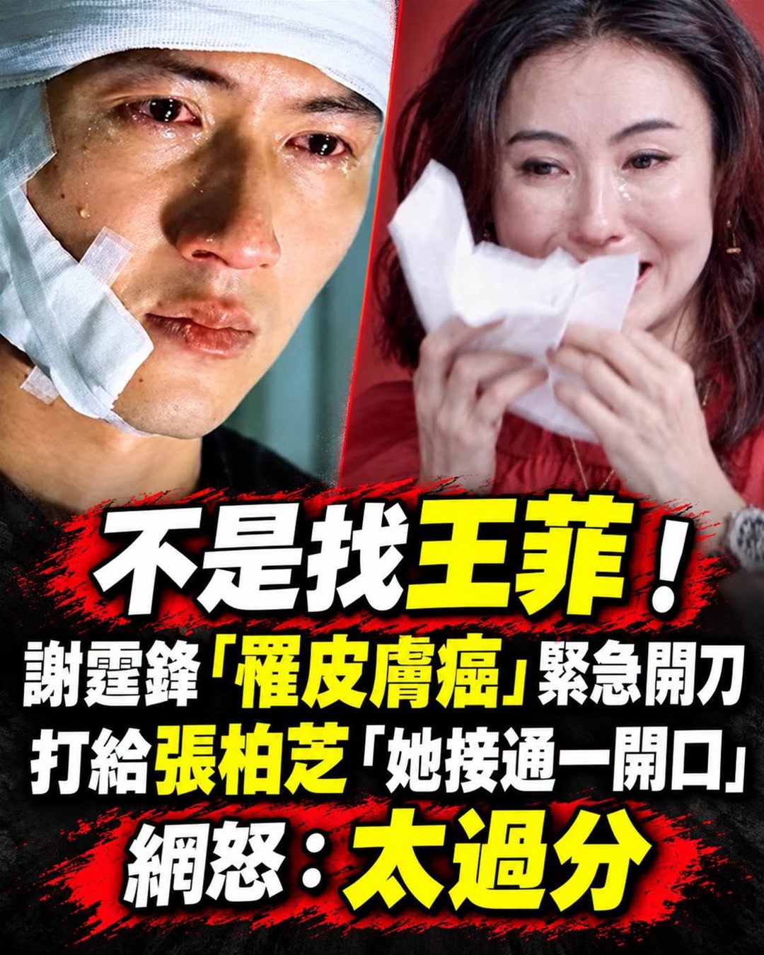 謝霆鋒剃光頭驚見黑斑,得知要開刀後第一通電話竟打給張柏芝