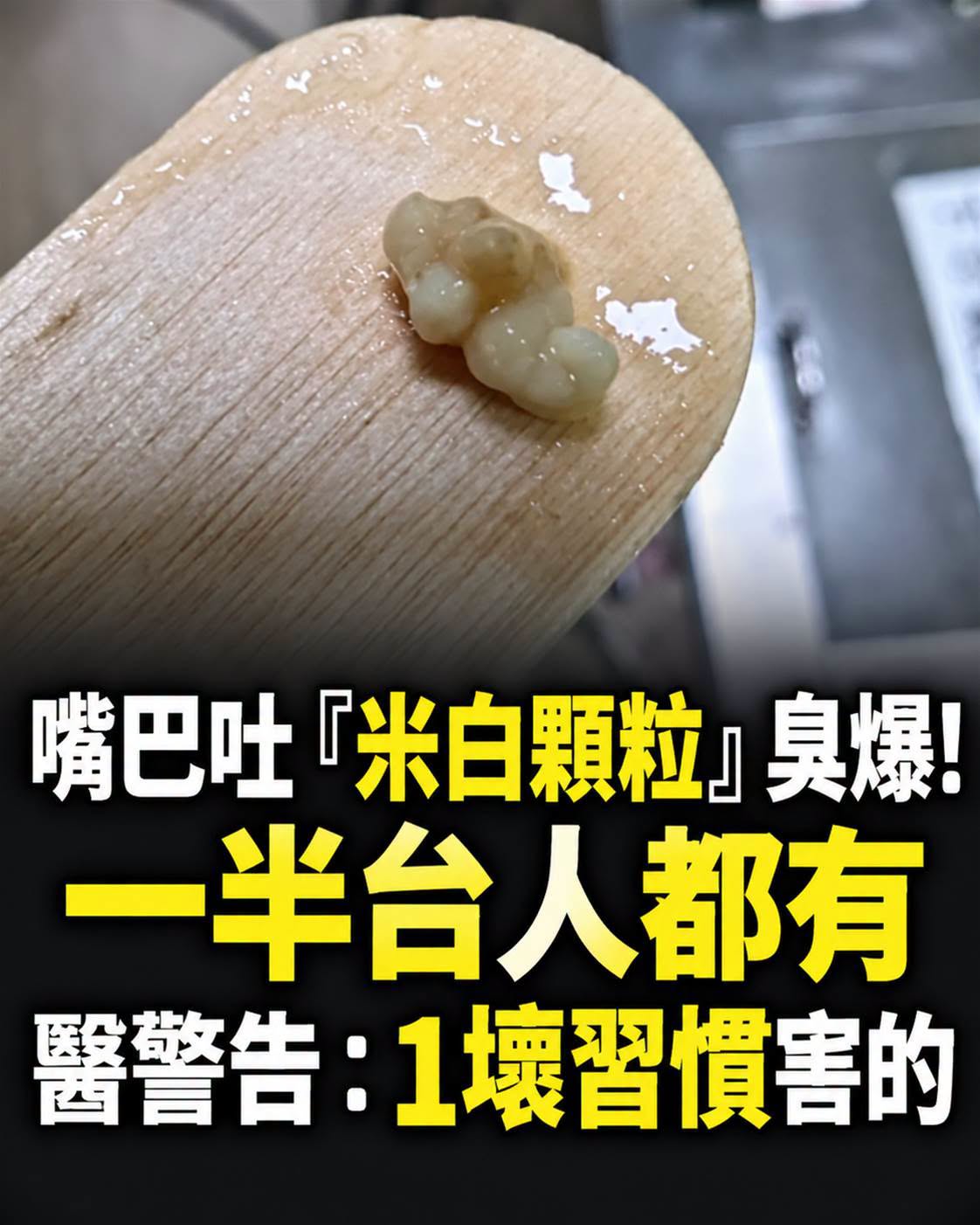 嘴巴吐「米白顆粒」臭爆,一半台灣人都有,醫師提醒1個用藥習慣