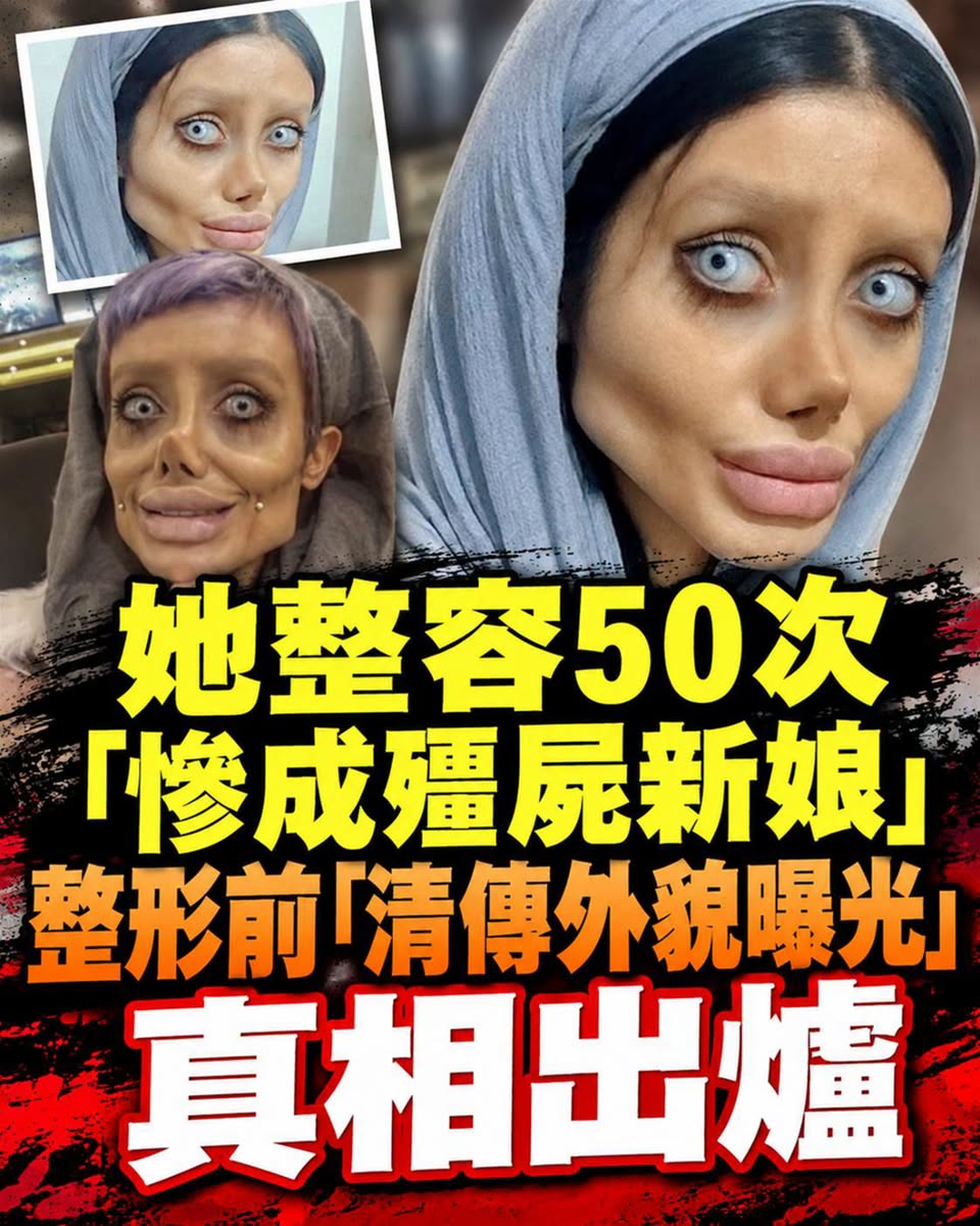 19歲少女宣稱整容50次，曬出「殭屍新娘」照，網友追問真相後劇情急轉
